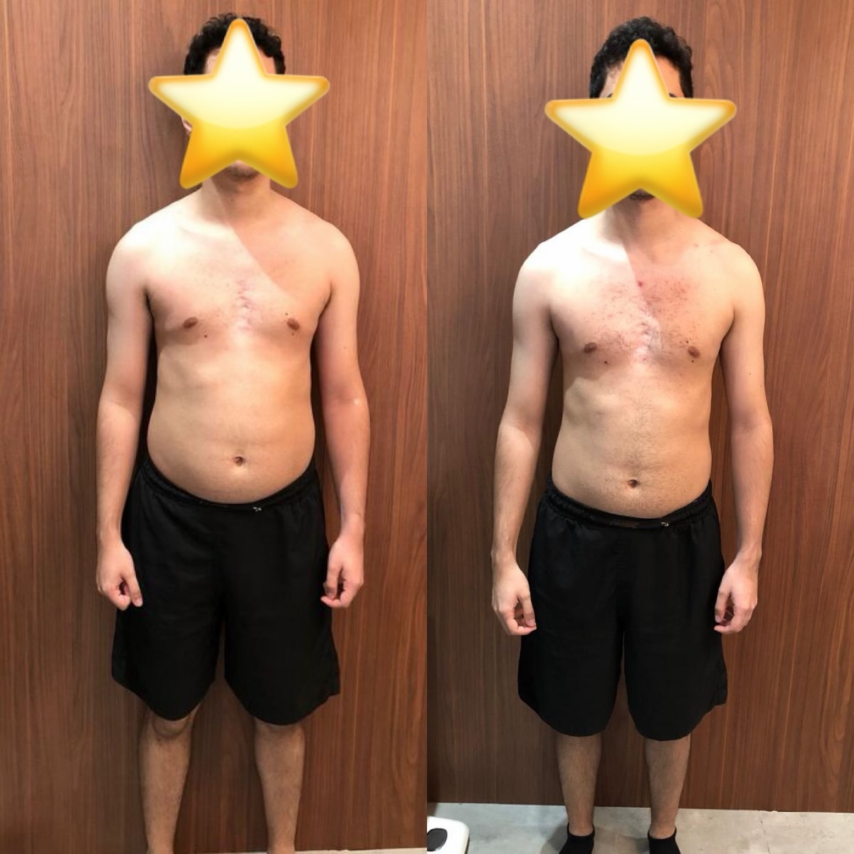 Transformação de paciente da Clínica Energia Vital — antes e depois do acompanhamento nutricional