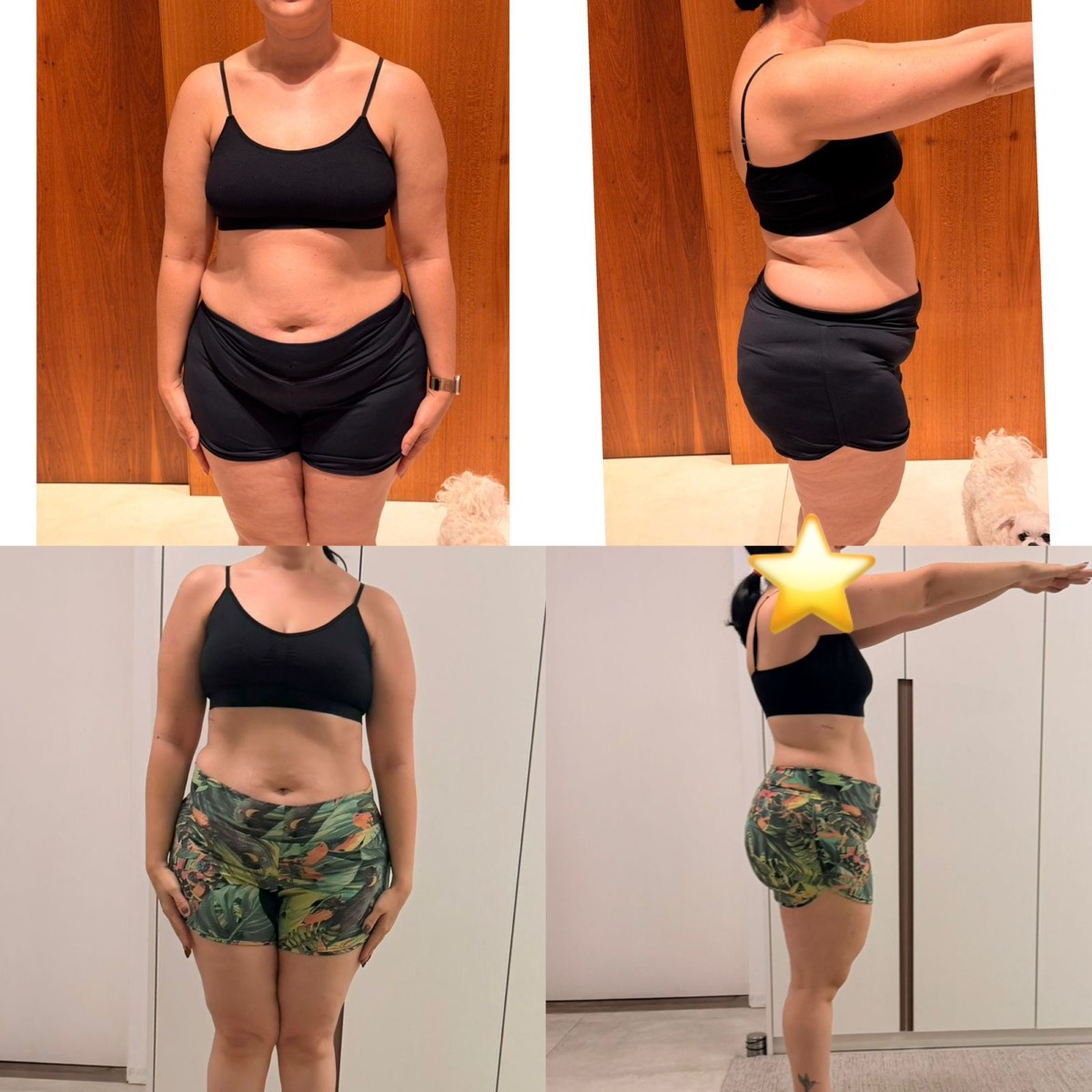 Transformação de paciente da Clínica Energia Vital — antes e depois do acompanhamento nutricional