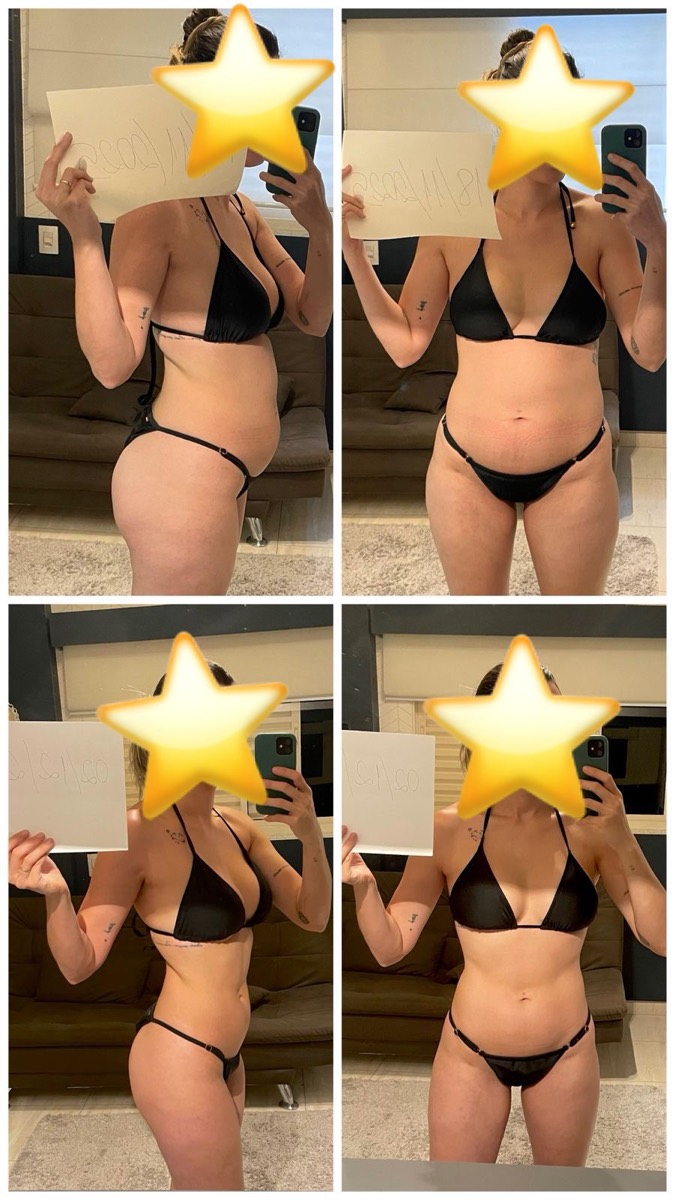Transformação de paciente da Clínica Energia Vital — antes e depois do acompanhamento nutricional