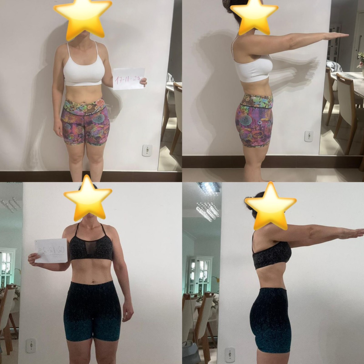 Transformação de paciente da Clínica Energia Vital — antes e depois do acompanhamento nutricional