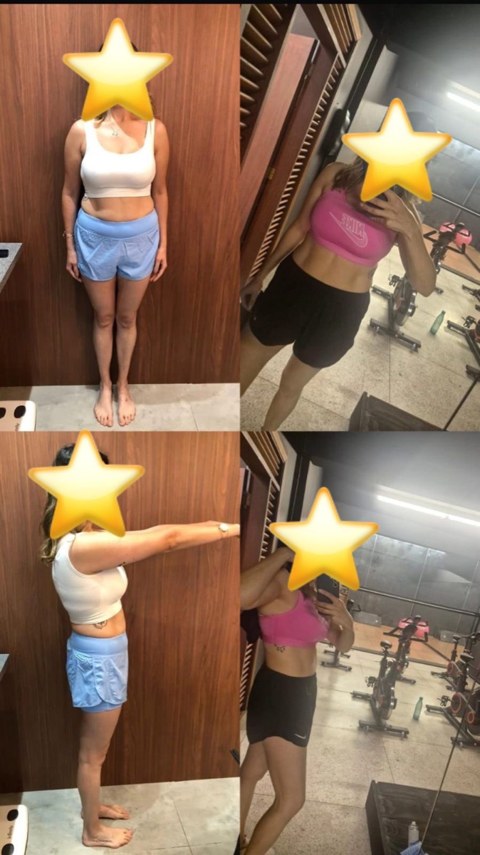 Transformação de paciente da Clínica Energia Vital — antes e depois do acompanhamento nutricional