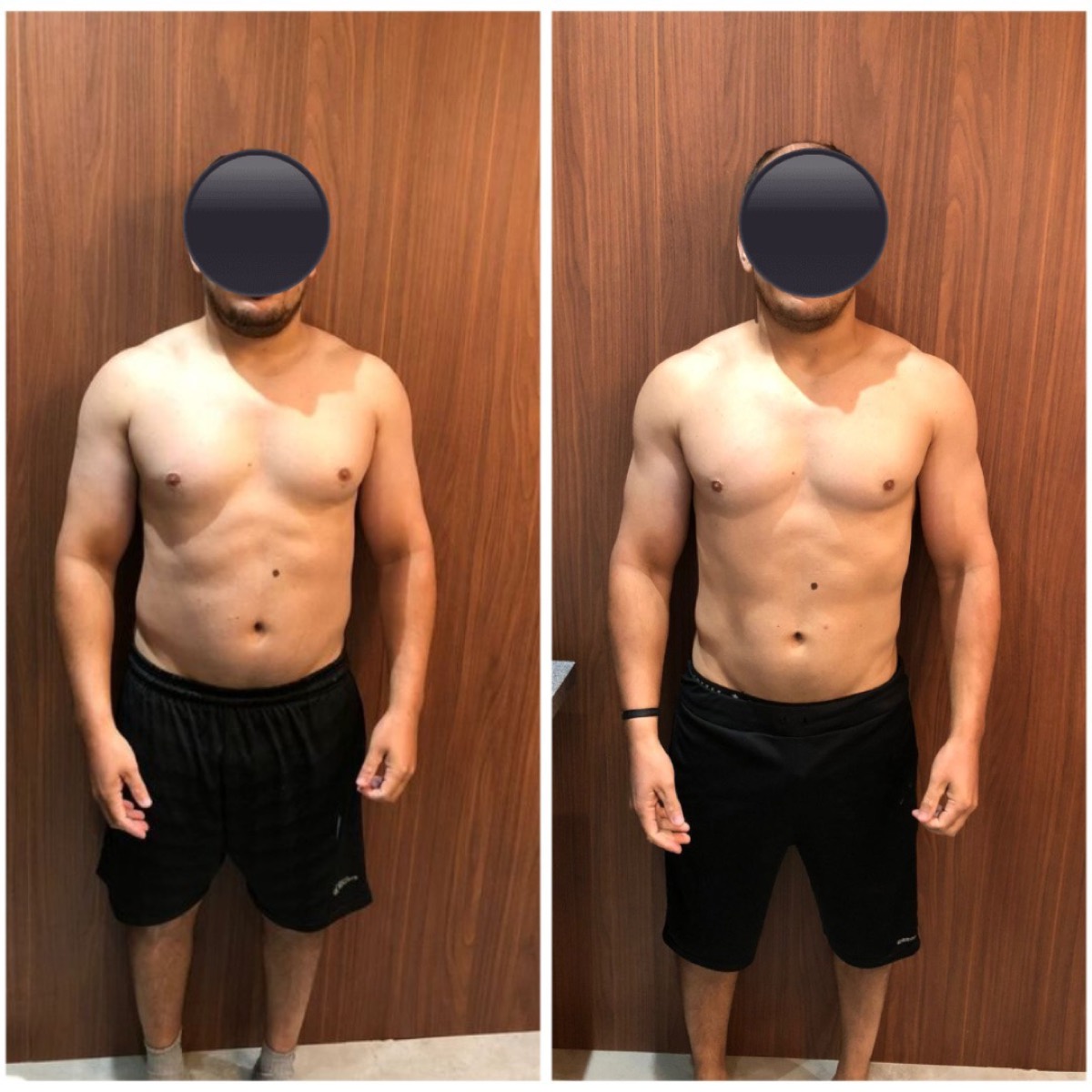 Transformação de paciente da Clínica Energia Vital — antes e depois do acompanhamento nutricional