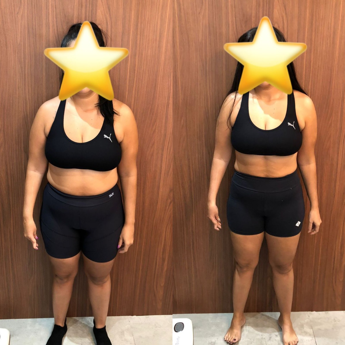 Transformação de paciente da Clínica Energia Vital — antes e depois do acompanhamento nutricional